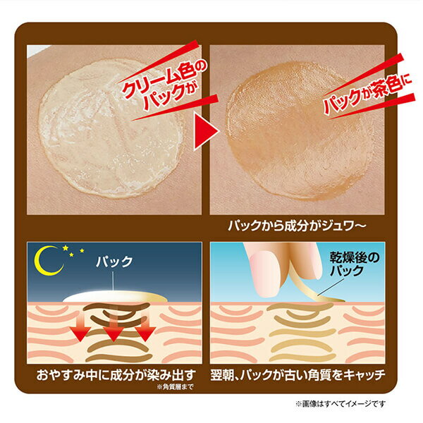 【6/25(水)限定！楽天カード利用でポイント8倍！】アトネールEX 15g パック 角質 ボディ用 3本セット 送料無料