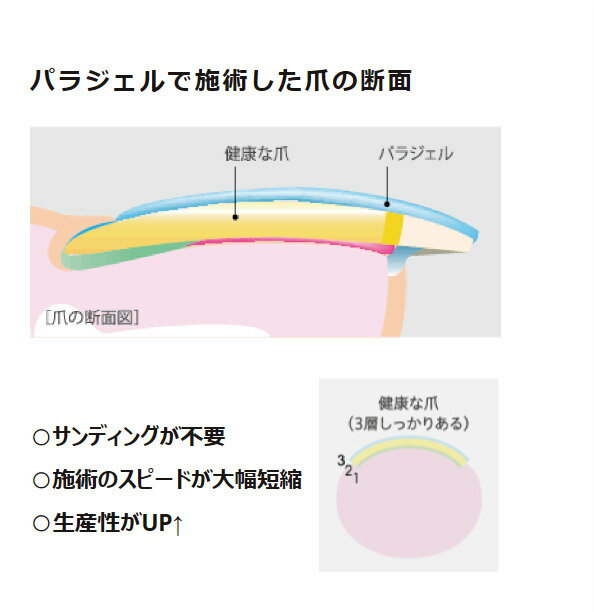 ������ȯ���ġ�para gel �ѥ饸���� ���ꥢ������EX 10g �ڥͥ��� ������ͥ��� �ѥ饸���� �١��������� ���������� ����եͥ��� ��եȤ��ˤ��� ��Ż��˶��� ̩���ϡ�