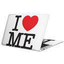 MacBook p XLV[ }bNubN 13C` ` 16C` MacBook Pro / MacBook Air eΉ m[gp\R Jo[ P[X tB XebJ[ ANZT[ ی 000922 p@n[g