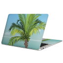 MacBook p XLV[ }bNubN 13C` ` 16C` MacBook Pro / MacBook Air eΉ m[gp\R Jo[ P[X tB XebJ[ ANZT[ ی 001430 ₵̖؁@C