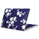 MacBook p XLV[ }bNubN 13C` ` 16C` MacBook Pro / MacBook Air eΉ m[gp\R Jo[ P[X tB XebJ[ ANZT[ ی 008211 ԁ@@@͗l@u[