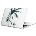 MacBook p XLV[ }bNubN 13C` ` 16C` MacBook Pro / MacBook Air eΉ m[gp\R Jo[ P[X tB XebJ[ ANZT[ ی 016461 V̖؁@A