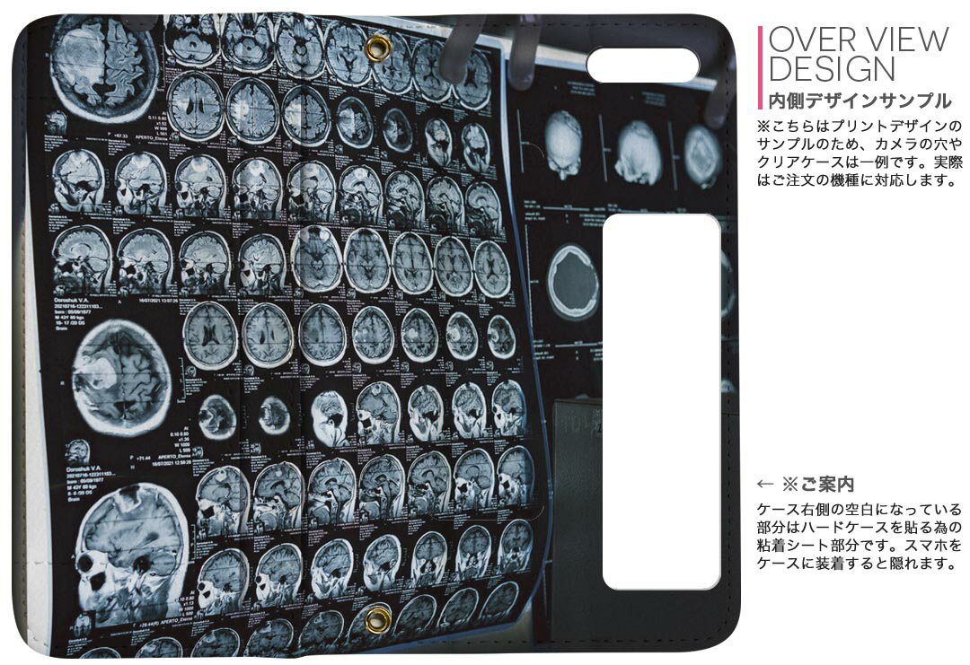 Galaxy A52 5G 用 手帳型 内側プリント ケース カバー SC-53B 対応 ケース カバー 手帳型 sc53b マグネット式 ピタッと閉まる レザーケース カード収納 ポケット 023989 レントゲン　写真