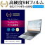 ASUS TransBook Mini R106HA [10.1] ǻȤ  饹ե  Ʊ 9H ֥롼饤ȥå   վݸե ᡼̵