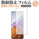 Xiaomi Mi 11 Pro p wh~ NA یtB ʕی V[g [֑