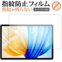 teclast P30S [ tp ] tی tB wh~ NA ʕی V[g [֑