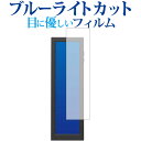 ＼5日はポイント最大5倍／ ELSONIC EK-MD088 保護 フィルム ブルーライトカット 反射防止 保護フィルム 指紋防止 メール便送料無料