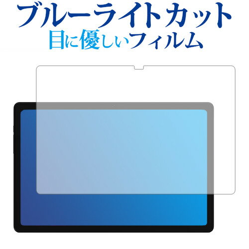 ALLDOCUBE iPlay 50 Pro 液晶保護 フィルム ブルーライトカット 反射防止 保護フィルム 指紋防止 メール便送料無料