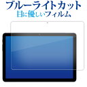 AAUW P60 ( 10.1インチ ) 液晶保護 フィルム ブルーライトカット 反射防止 保護フィルム 指紋防止 メール便送料無料 jgs bgt