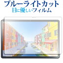 NEC LAVIE Tab T11d ( 11.0型・2025年2月発売モデル ) 液晶保護 フィルム ブルーライトカット 反射防止 保護フィルム 指紋防止 メール便送料無料(2)