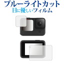 GoPro Hero11 Black / Hero10 Black / Hero9 Black CETup p u[CgJbg ˖h~ یtB wh~ ttB [֑