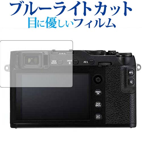 20P5!! FUJIFILM X-E3 / X-T20 / X-T10 / X-A2 ֥롼饤ȥå ȿɻ վݸե ɻ վե ᡼̵ jgs bgt