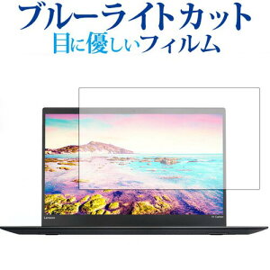 ThinkPad X1 Carbon (2017ǯǥ) / Lenovo ֥롼饤ȥå ȿɻ վݸե ɻ վե ᡼̵