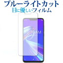 ASUS ZenFone Max (M2) ZB633KL 前面のみ 専用 ブルーライトカット 反射防止 液晶保護フィルム 指紋防止 液晶フィルム メール便送料無料