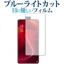 Elephone U2 p u[CgJbg ˖h~ tیtB [֑