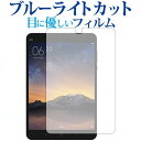 Xiaomi Mi Pad 2/xiaomip u[CgJbg ˖h~ tیtB wh~ ttB [֑