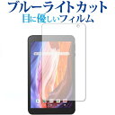VANKYO MatrixPad S7 専用 ブルーライトカット 反射防止 保護フィルム 指紋防止 液晶フィルム メール便送料無料 jgs bgt 互換品