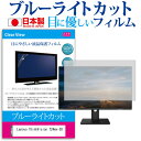 Lenovo ThinkVision T24mv-30 [23.8C`] ی tB Jo[ V[g u[CgJbg ˖h~ wh~ CAX R tیtB [֑