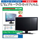 _25̓|Cg10{!!^ Lenovo ThinkCentre M910z All-in-One [23.8C`] @Ŏg u[CgJbg ˖h~ wh~ tیtB [֑