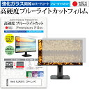 ＼30日はポイント最大5倍／ BenQ XL2420