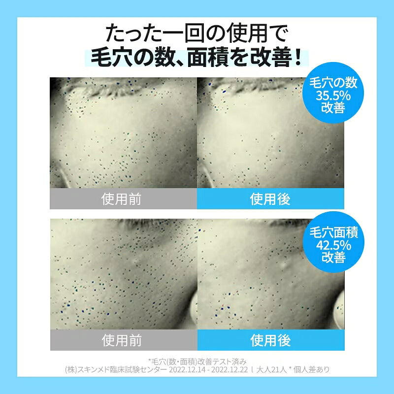 クーリングパッド 70枚入り/お風呂後ほてりケア/ 毛穴パッド/ 韓国コスメ/ 韓国スキンケア/ コスメ/ スキンケア/ 保湿 / 水分/ 低刺激 パッド / 赤み / 運動やサウナパッド/ cellfusionc-10000015 Cell Fusion C 楽天市場店 サンプル画像3