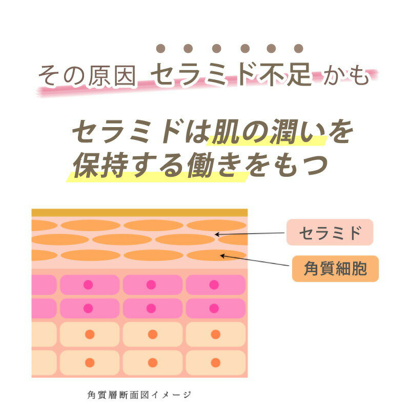 セラミド不足かも