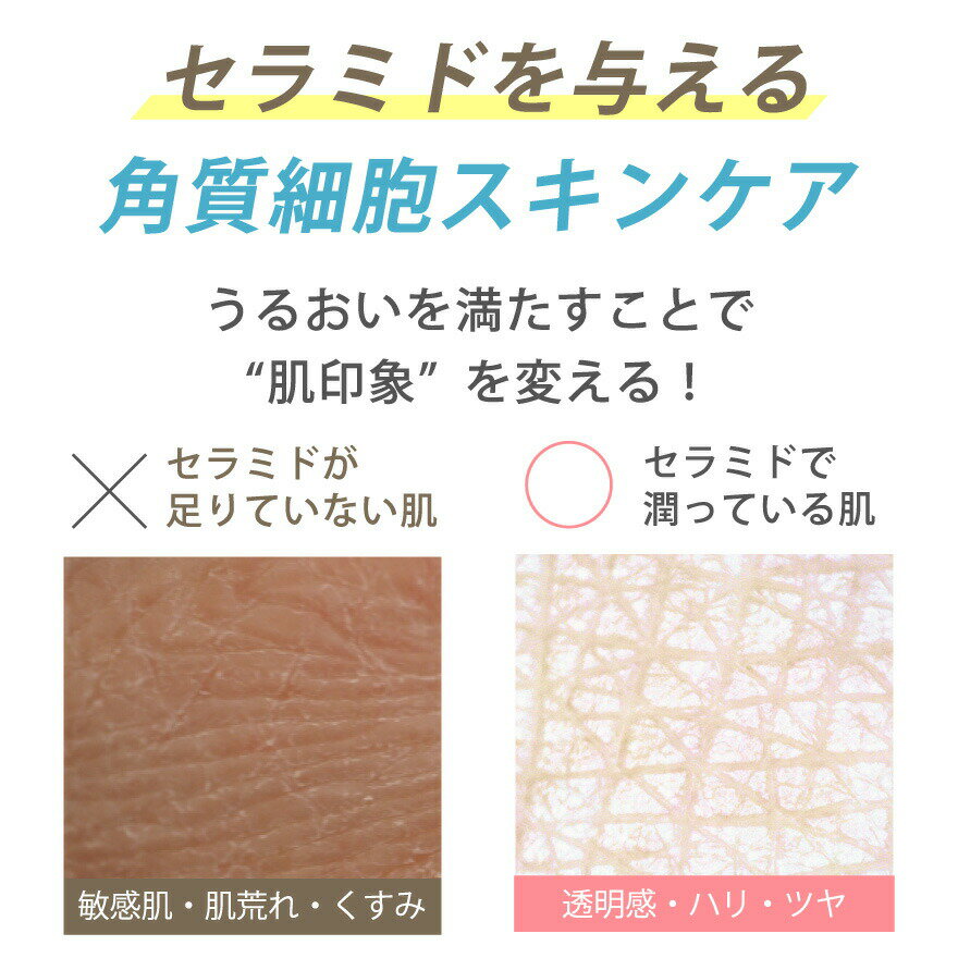 角質細胞スキンケア