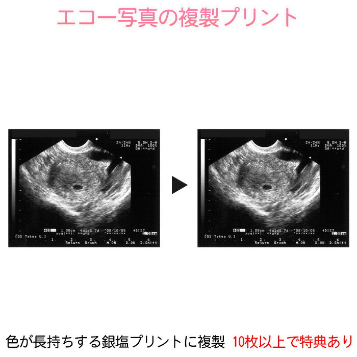 エコー写真の複製プリント エコー