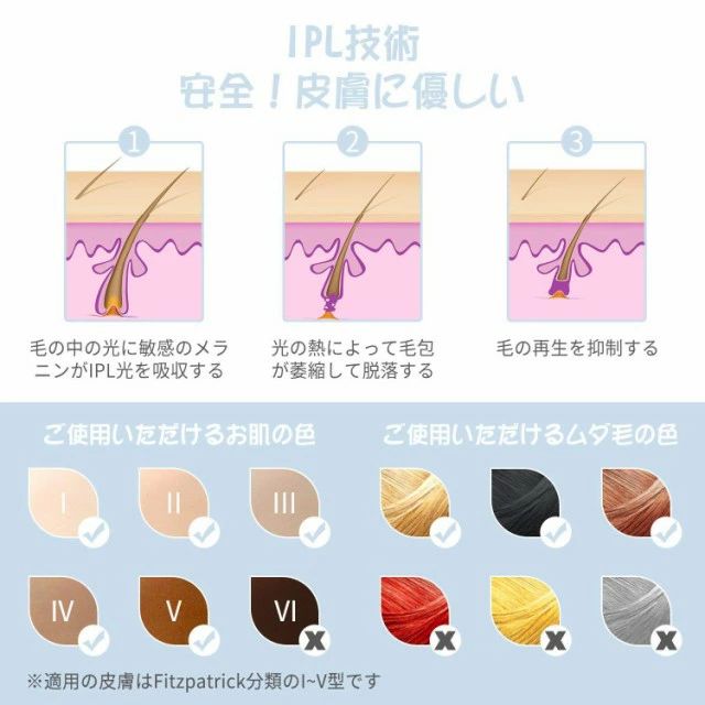 男女兼用 35万ショット 脱毛器 5段階調整 家庭用 シルクエキスパート IPL光脱毛器 ...