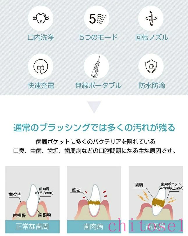 期間限定5%クーポン 口腔洗浄器 ジェットウォッシャー ウォーターフロス 携帯用 口...