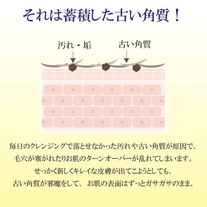 お試しクロフィア アクアジェル ピーリング ジェル 角質ケア 角質除去 角質とり 柚子 ゆず 顔 鼻 洗顔 毛穴 黒ずみ ニキビ 人気 新発売 ナチュラル 自然 天然 敏感肌 ウォーター ゲル クリーム 敏感肌 うるおい 小じわ 送料無料 メンズ 角栓 スキンケア