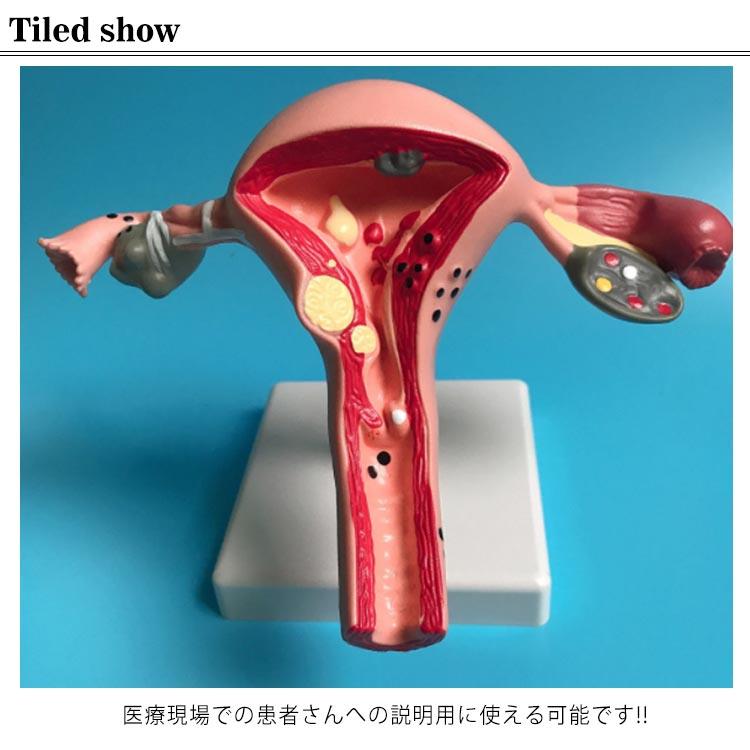coco-ailesの標本 子宮 人体模型 模型 膣 卵巣模型 女性生殖器 女性子宮 女性卵巣 生殖器 子宮モデル 女性生殖器モデル 卵巣モデル人体モデル 女性 教材 実験｜アングル2