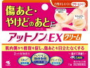 【ポイント2倍★19日20:00~26日1:59迄】【第2類医薬品】薬)小林製薬 アットノンEXクリーム 15g 皮膚の薬 医薬品
