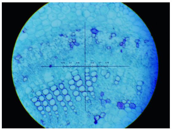 �ڥ�ӥ塼��Ƥ�100��OFF�����ݥ�ۡڤ����󤻡ۥ����ȡ� �ߥ����᡼���� TS-8LEN-100WT ���ؼ�¬��� ¬�� ���