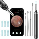 耳かき カメラ カメラ付き耳かき みみかき 耳掃除 スコープ イヤースコープ 極細 3.5mm 500万画素 1080P IP67防水 お年寄り 子供 耳垢クリーニング 耳掻き セット 無線WIFI接続 簡単に繋がり IOS(4)