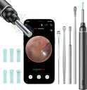 耳かき カメラ カメラ付き耳かき みみかき 耳掃除 スコープ イヤースコープ 極細 3.5mm 500万画素 1080P IP67防水 お年寄り 子供 耳垢クリ...