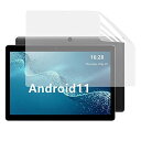 ALLDOCUBE iPlay20S 10.1 用の ブルーライトカットフィルム 反射低減 抗菌 アンチグレア 指紋防止 気泡防止 液晶 保護フィルム 画面保護...