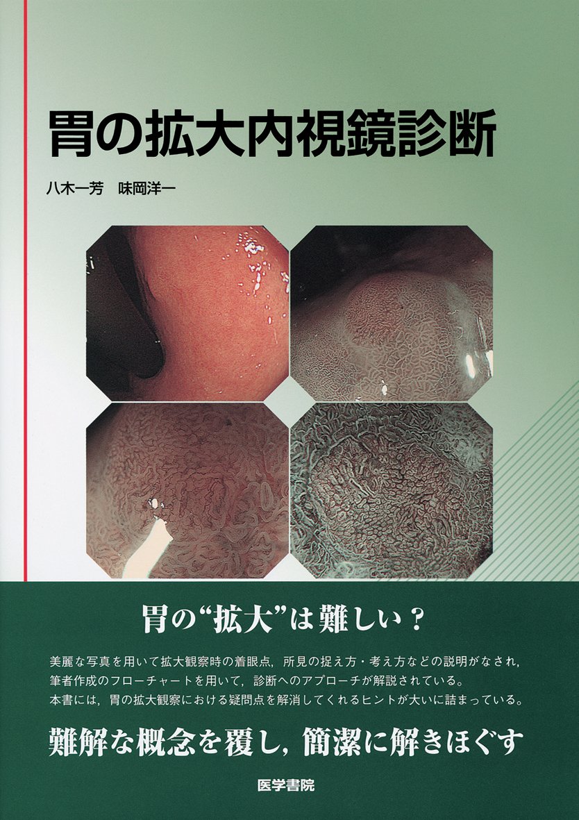 【中古】胃の拡大内視鏡診断