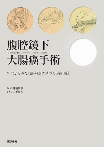 ご来店ありがとうございます。昭和・平成のCD、DVD、家電、音響機器など希少な商品も多数そろえています。レコード、楽器の取り扱いはございません。掲載していない商品もお探しいたします。映像商品にはタイトル最後に[DVD]、[Blu-ray]と表記しています。表記ないものはCDとなります。お気軽にメールにてお問い合わせください。腹腔鏡下大腸癌手術: 発生からみた筋膜解剖に基づく手術手技【メーカー名】医学書院【メーカー型番】【ブランド名】医学書院【商品説明】腹腔鏡下大腸癌手術: 発生からみた筋膜解剖に基づく手術手技・中古品（ユーズド品）について商品画像はイメージです。中古という特性上、使用に影響ない程度の使用感・経年劣化（傷、汚れなど）がある場合がございます。商品のコンディション、付属品の有無については入荷の度異なります。また、中古品の特性上、ギフトには適しておりません。商品名に『初回』、『限定』、『〇〇付き』等の記載がございましても、特典・付属品・保証等は原則付属しておりません。付属品や消耗品に保証はございません。当店では初期不良に限り、商品到着から7日間は返品を受付けております。注文後の購入者様都合によるキャンセル・返品はお受けしていません。他モールでも併売している商品の為、完売の際は在庫確保できない場合がございます。ご注文からお届けまで1、ご注文⇒ご注文は24時間受け付けております。2、注文確認⇒ご注文後、当店から注文確認メールを送信します。3、在庫確認⇒新品、新古品：3-5日程度でお届け。※中古品は受注後に、再検品、メンテナンス等により、お届けまで3日-10日営業日程度とお考え下さい。米海外倉庫から取り寄せの商品については発送の場合は3週間程度かかる場合がございます。　※離島、北海道、九州、沖縄は遅れる場合がございます。予めご了承下さい。※配送業者、発送方法は選択できません。お電話でのお問合せは少人数で運営の為受け付けておりませんので、メールにてお問合せお願い致します。お客様都合によるご注文後のキャンセル・返品はお受けしておりませんのでご了承下さい。ご来店ありがとうございます。昭和・平成のCD、DVD、家電、音響機器など希少な商品も多数そろえています。レコード、楽器の取り扱いはございません。掲載していない商品もお探しいたします。映像商品にはタイトル最後に[DVD]、[Blu-ray]と表記しています。表記ないものはCDとなります。お気軽にメールにてお問い合わせください。