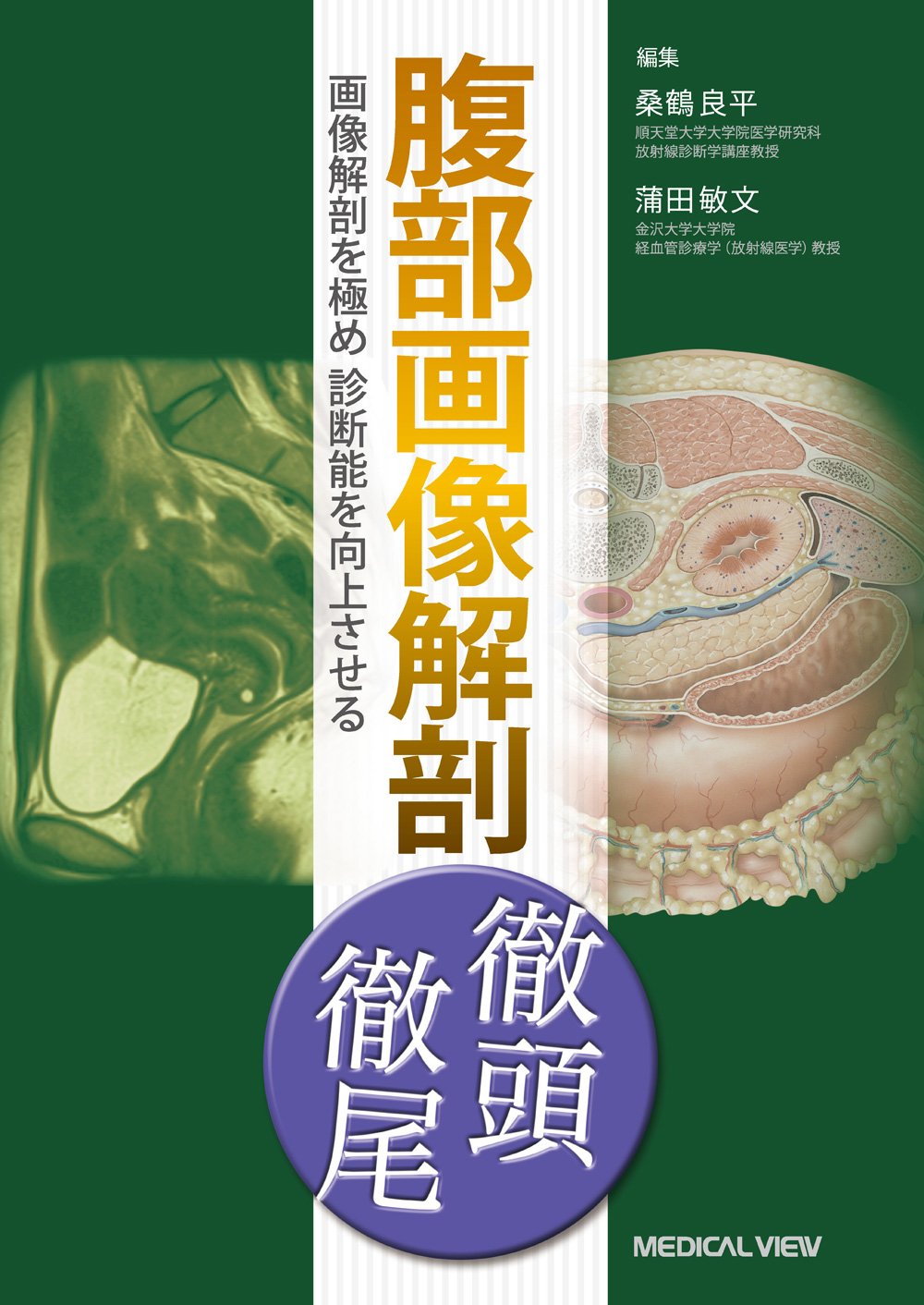 Medicine, Pharmacy - 【中古】腹部画像解剖 徹頭徹尾−画像解剖を極め診断能を向上させる