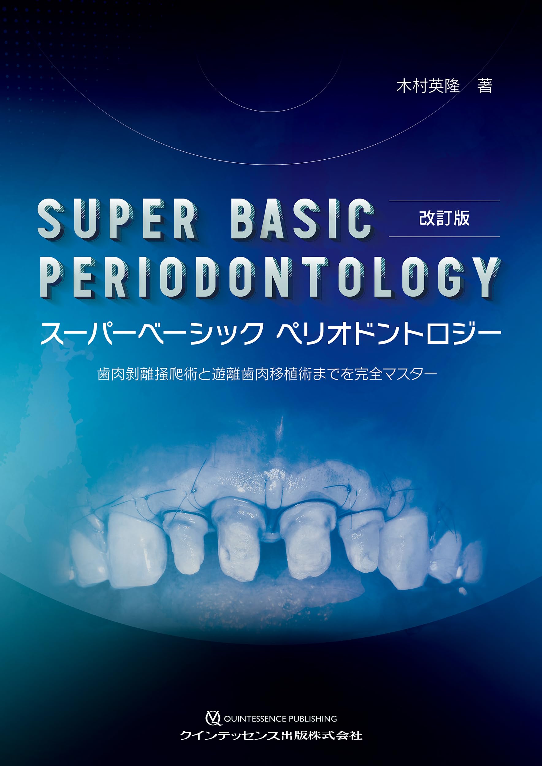 【中古】改訂版 スーパーベーシック ペリオドントロジー: 歯肉?離掻爬術と遊離歯肉移植術までを完全マスター