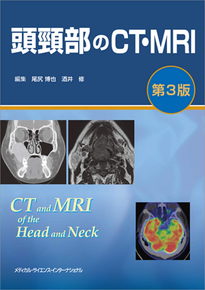 Medicine - 【中古】頭頸部のCT・MRI 第3版