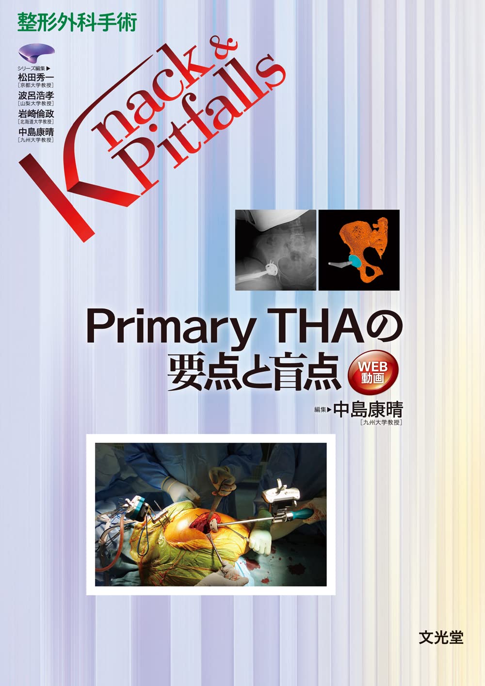 Primary THAの要点と盲点 (整形外科手術Knack & Pitfalls)