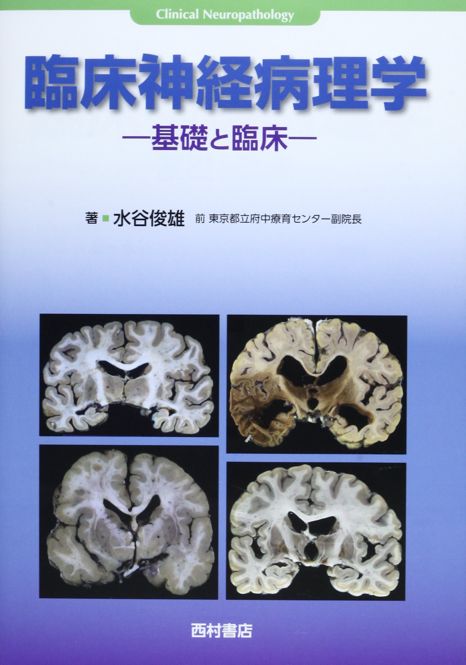 【中古】臨床神経病理学: 基礎と臨床