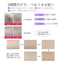 IPL光脱毛器光脱毛器家庭用脱毛器男女兼用脱毛機ムダ毛処理脱毛機ムダ毛ケア脱毛器光脱毛器家庭用脱毛器男女兼用脱毛機ムダ毛処理メンズレディースムダ毛ケア50万