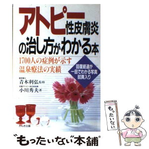 【中古】 アトピー性皮膚炎の治し方がわかる本 1700人の症例が示す温泉療法の実績 / 小川 秀夫 / かんき出版 [単行本]【メール便送料無料】【あす楽対応】