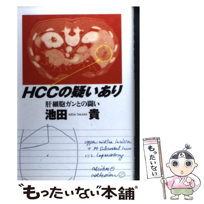 【中古】 HCCの疑いあり 肝細胞ガンとの闘い / 池田 貴 / 幻冬舎 [単行本]【メール便送料無料】【あす楽対応】