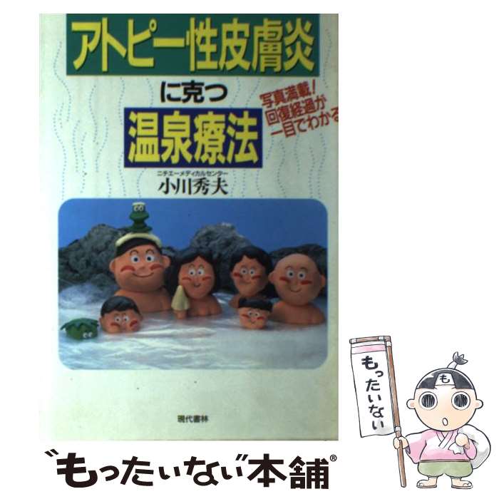 【中古】 アトピー性皮膚炎に克つ温泉療法 写真満載！回復経過が一目でわかる / 小川 秀夫 / 現代書林 [単行本]【メール便送料無料】【あす楽対応】