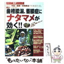  歯槽膿漏、蓄膿症にナタマメが効く！！ 昔から中国の薬膳や民間療法でも有名だった、膿出しの / 主婦の友インフォス / 主婦の友イ 