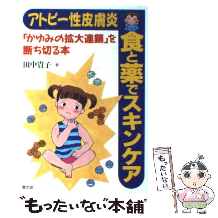 楽天もったいない本舗　楽天市場店【中古】 アトピー性皮膚炎食と薬でスキンケア 「かゆみの拡大連鎖」を断ち切る本 / 田中 貴子 / 農山漁村文化協会 [単行本]【メール便送料無料】【あす楽対応】